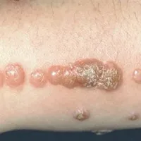 Ponoči, ko človek spi, se stenice prehranjujejo z njegovo krvjo.