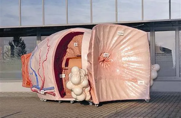 Model prostate, dolg pet metrov