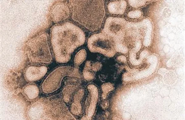 Virus H1N1 tudi pri nas vse bolj napada prebivalstvo 