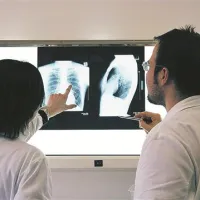 Referenčne ambulante naj bi skrbele tudi za načrtno odkrivanje nevarnih obolenj med prebivalstvom 