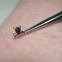 Prisesanega klopa je treba previdno odstraniti s posebno pinceto