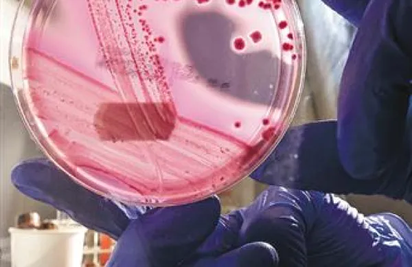 Bakterija Enterohaemorrhagic Escherichia coli (Ehec).
