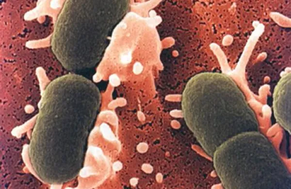 Ena od oblik E. coli