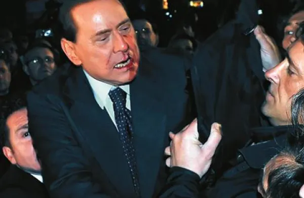 Marca je Berlusconi prestal tudi operacijo na čeljusti, in sicer zaradi posledic napada v Milanu decembra 2009.