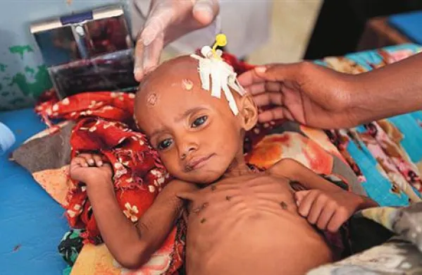 V Somaliji zaradi lakote pomoč potrebuje 10 milijonov ljudi.