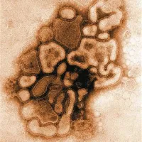 Virus A H5N1