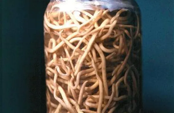 Gliste