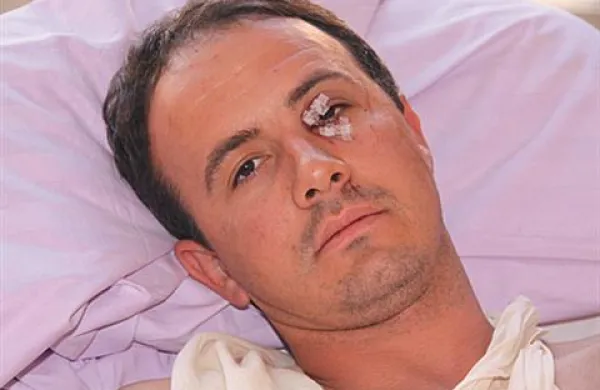 Policisti osumljenih še niso uspeli identificirati, zato naprošajo vse, ki bi karkoli vedeli o osebi na priloženi fotografiji, da to sporočijo na telefonsko številko 113 ali anonimni telefon policije 080 1200