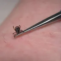 Klopa odstranite previdno, s posebno pinceto, nikar ga ne trgajte in ne dušite z oljem