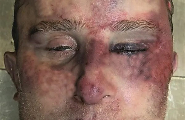 Identiteta pokojnega ni znana, zato prosijo vse, ki bi ga prepoznali na fotografiji, da obvestijo policijo na telefonsko  številko 113 ali  na anonimni telefon policije 080 1200