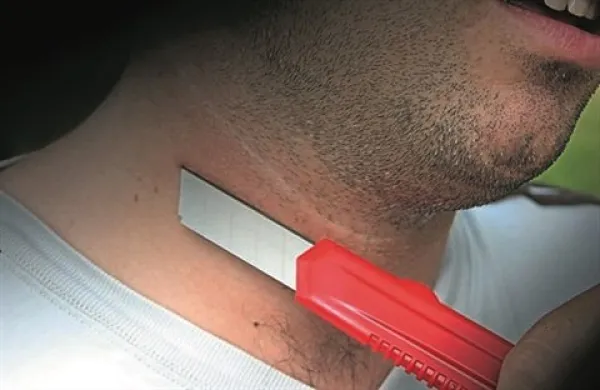 Fotografija je simbolična