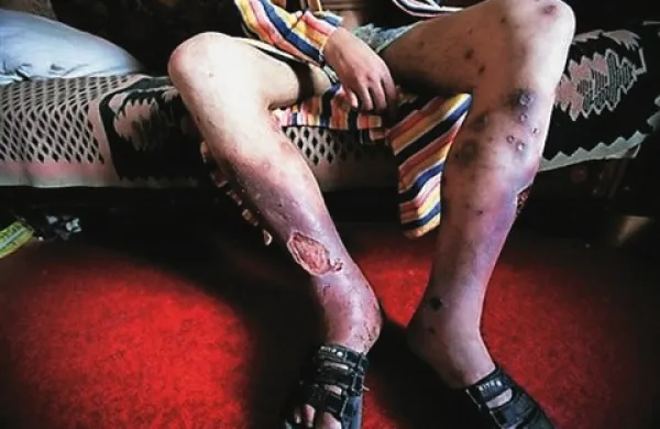 Hrvaški spletni mediji so konec tedna objavili novico, da so policisti v Osijeku prijeli pet domačinov, ki naj bi prodajali drogo krokodil