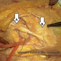 Dokaj pozno odkrit, a pomemben ligament 