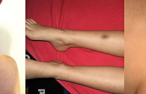 Podplutbe, udarnine in praske po telesu desetletnika so pediatra vzpodbudile, da je poklical policijo. Za svoja dejanja mlajši od 14 let niso kazensko odgovorni. 