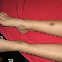 Desetletnega dečka so sošolci pretepli, pediater, ki ga je zdravil, je poklical policijo.