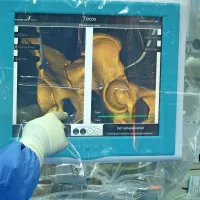   

Izvedbo osteotomije preverijo na monitorju  na navigacijski 
napravi s 3D pogledom. 