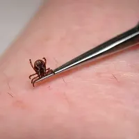 Klopa previdno odstranimo s pinceto. 