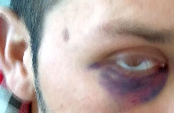 Dori si bo svoje podvige pri nas zapomnil tudi po težkih rokah 
trenutno še neznanih policistov.