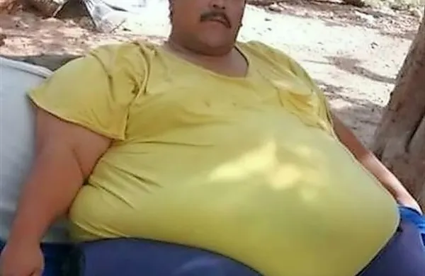 Mehičan, ki je nekoč veljal za najdebelejšega človeka na 
svetu, je v starosti 38 let umrl zaradi odpovedi srca, le dva 
meseca po operaciji, s katero so mu zmanjšali želodec.

