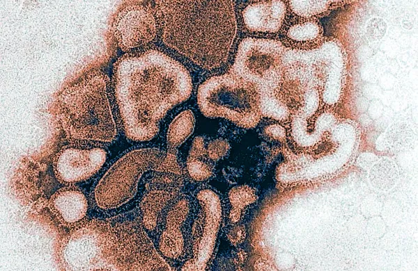 Virus prašičje gripe oziroma AH1N1 