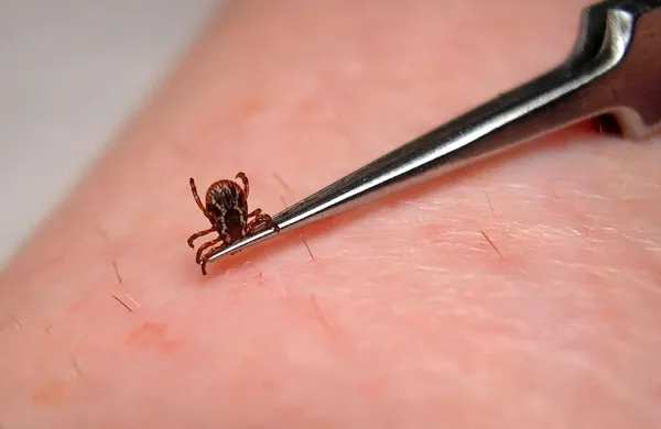 Klopa odstranjujemo le s pinceto, ne s kapljico olja, ki ga 
zaduši in zato izbrizga okuženo slino v naše telo. 