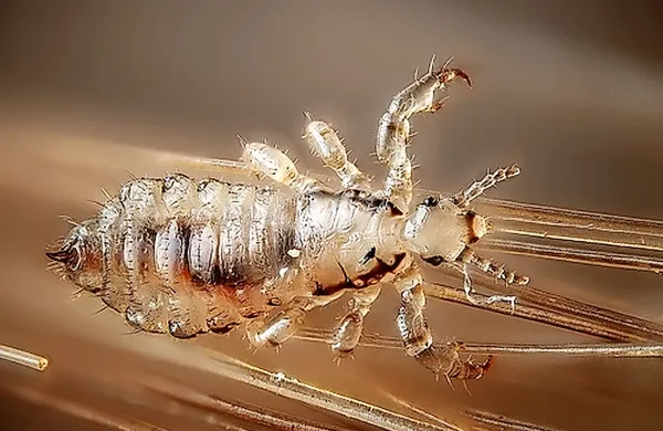 Starši so deklici poskušali naglavne uši odstraniti s pesticidom etiol, ki se ga uporablja v kmetijstvu za zatiranje 
insektov na rastlinah.