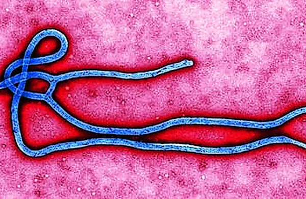 Virus ebole