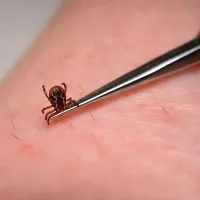 Klopa previdno izvlečemo s pinceto.
