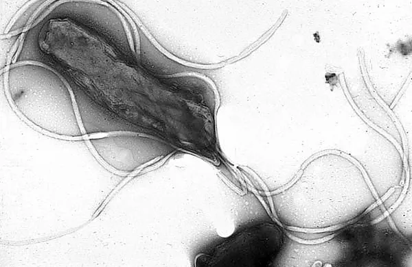 Helicobacter pylori pod mikroskopom 