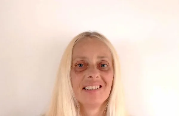 Darja Pugelj, vodja facebook skupine za 
samopomoč pri miasteniji gravis: “Osebni 
zdravniki bi morali biti bolje seznanjeni s to 
boleznijo, da bi obolele poslali takoj k nevrologu. 
Že tako so vrste zanje dolge.”