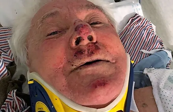 Potem ko so ga v Krvavem Potoku ustavili policisti, je končal 
na tleh s krvavim nosom in v lisicah.