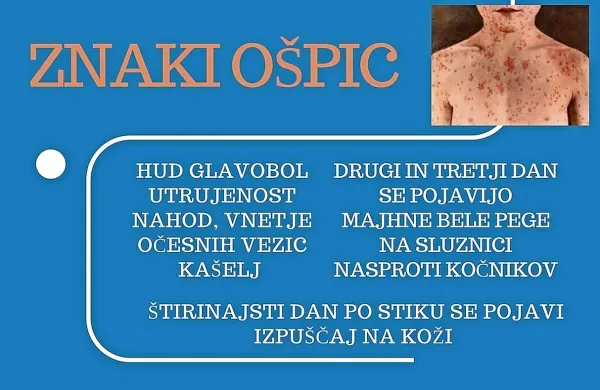 V prostorih Zdravstvenega doma Izola so izobesili informativni plakat o znakih ošpic ter  navodila, kako ravnati ob 
sumu na bolezen.