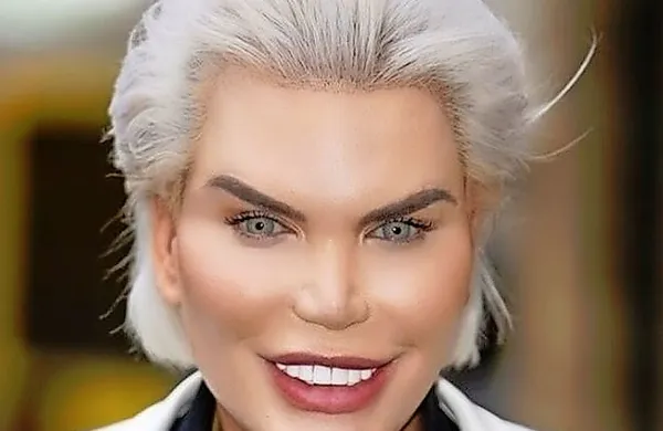  34-letni Rodrigo Alves je zelo znan po številnih “lepotnih” posegih 
(približno 60), za katere naj bi porabil pol milijona funtov.