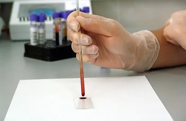 Prvi primer koronavirusa tudi v &Scaron;paniji