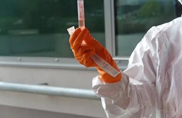 Zdravstveni delavec v roki drži test za koronavirus.

