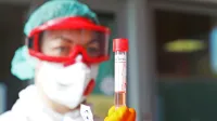 V Sežani po naključju odkrili &scaron;e dve osebi, pozitivni na test za covid-19