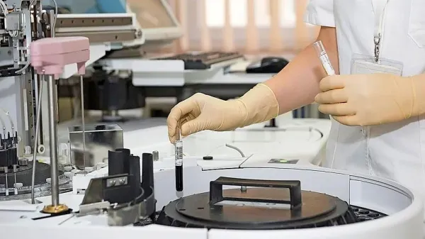 V Srbiji potrdili 344 novih okužb, 170 oseb potrebuje pomoč respiratorja