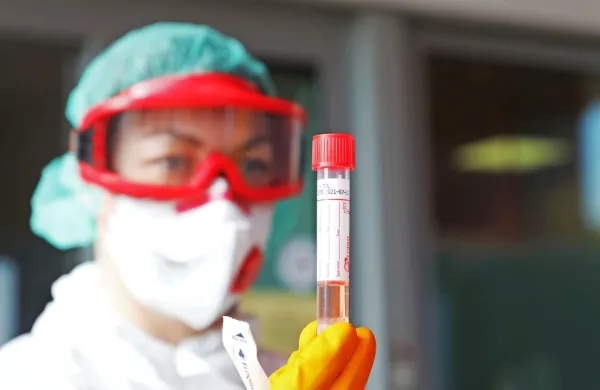 Včeraj potrdili 77 novih okužb, &scaron;tiri na Primorskem