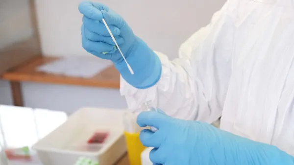 V nedeljo s PCR testi potrdili 244 okužb