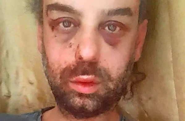 Vest je o napadu je prek družbenih omrežjih sporočil Antonio 
Parisi.