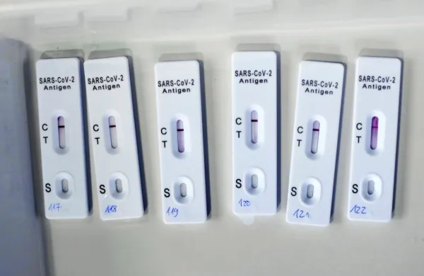 Hitre teste bo državi dobavil Sanolabor