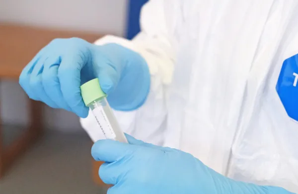 V GZS kritični do prenosa stro&scaron;ka testiranja vseh zaposlenih na delodajalce