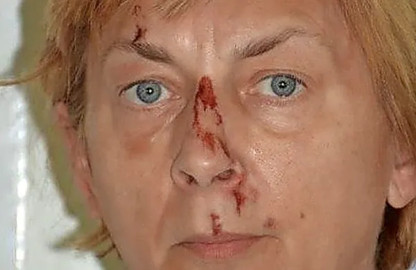    Identifikacija turistke, ki jo je na plaži na Krku našel   ribič, je 
zaposlila policije različnih držav.