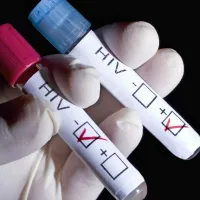 Lani je bilo na novo odkritih 27 Slovencev z virusom HIV.