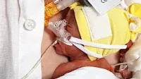 Medicina lahko danes da upanje na zdravega otroka tudi staršem, 
ki se jim rodi nedonošenček štiri mesece prezgodaj. 