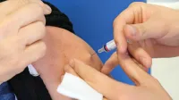 Cepljenje odraslih ponekod poteka v posebnih cepilnih ambulantah, drugod pri izbranih osebnih zdravnikih in v ambulantah 
za neopredeljene, v postojnskem ZD pa cepljenje poteka na oba 
načina. 
