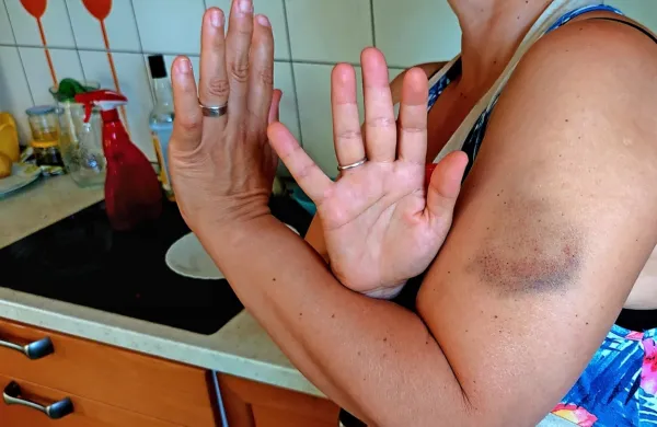V  Društvu  SOS    opozarjajo, da  je  nujen   predvsem konsenz o tem, da je za nasilje odgovoren le tisti, ki nasilje 
izvaja, in nihče drugi.