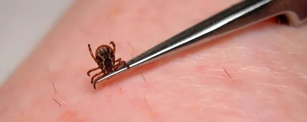 Tveganju okužbe so izpostavljeni ljudje vseh starostnih skupin, 
najpogosteje pa obolevajo osebe, stare med 55 in 64 let. 