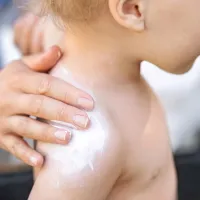 Nežna otroška koža je sploh potrebna ustrezne zaščite pred 
soncem.