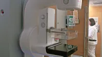 S premičnimi mamografi so v 16 letih progama presejanja raka dojke  Dora odkrili okrog 6000 rakov v začetni, za zdravljenje ugodni 
fazi.


